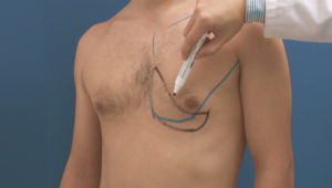 pectoralis-major